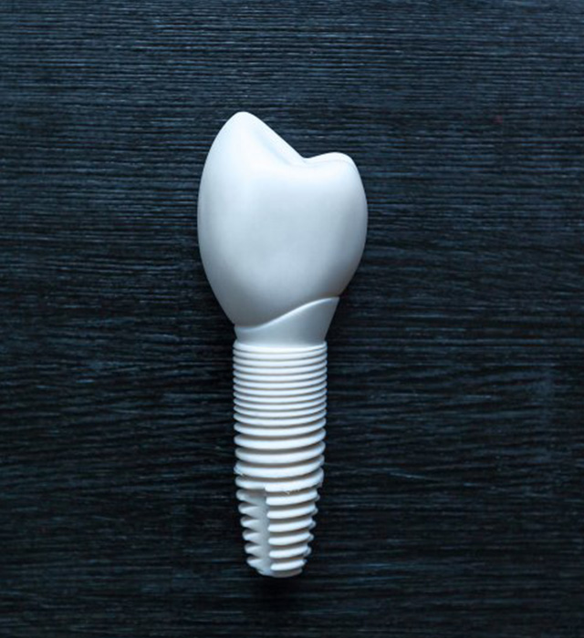 implant dentist modesto